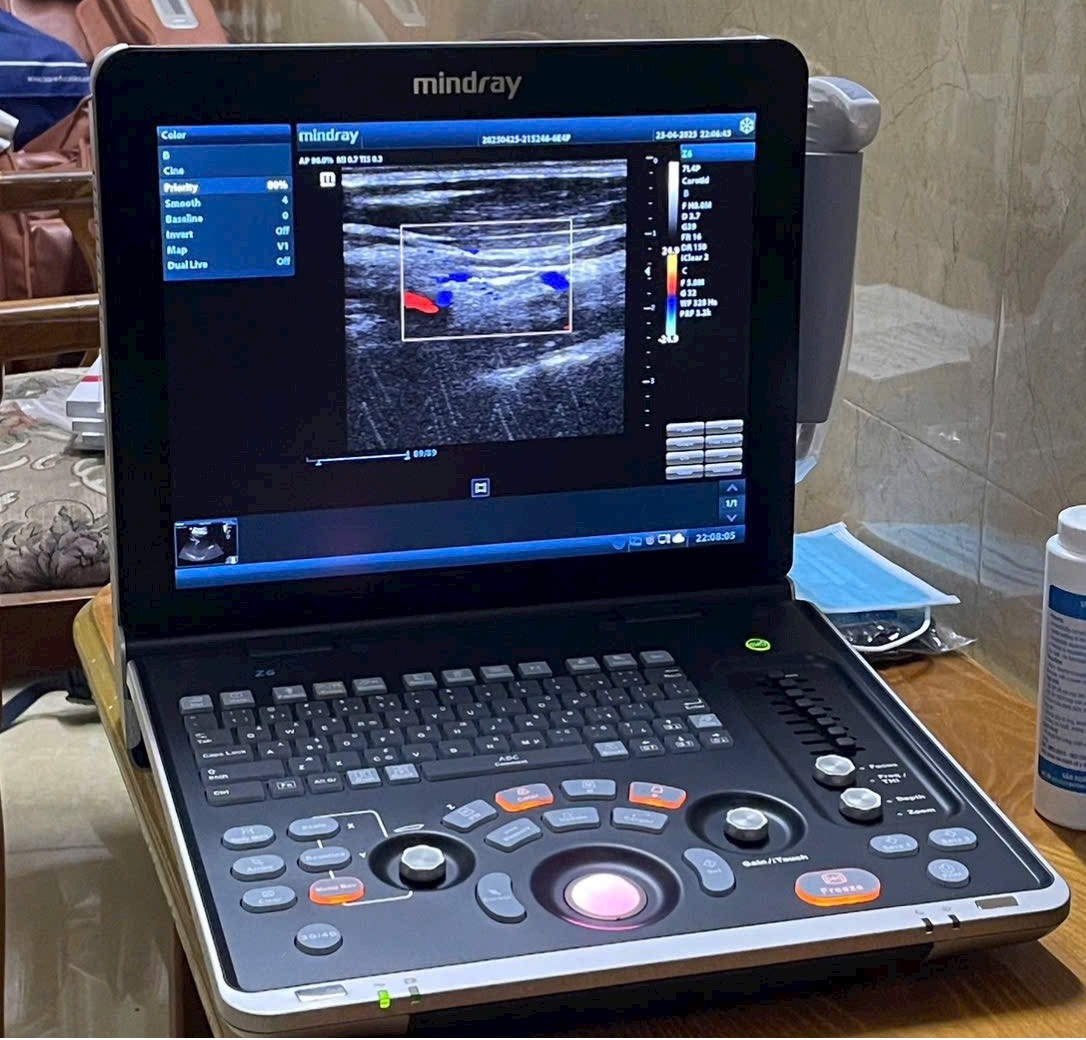 Bảng giá máy siêu âm xách tay SonoScape, Mindray, Chison, GE, Dawei tại Y Tế Việt Nhật